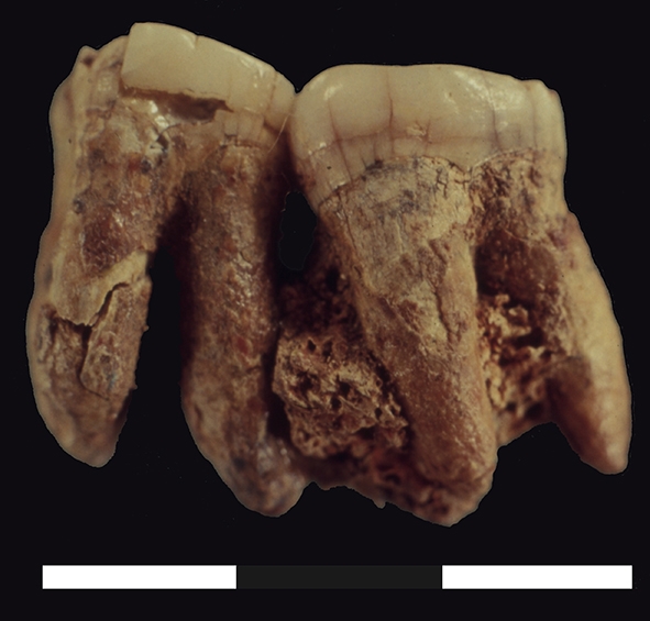 Hexian Homo erectus teeth